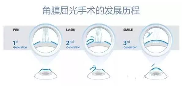 全飞秒与半飞秒的故事——90%之间的差距