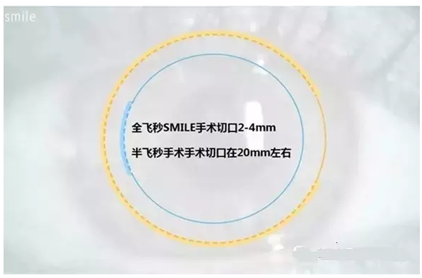 全飞秒与半飞秒的故事——90%之间的差距